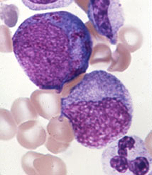 color atlas of hematology cap